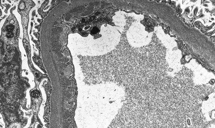 path---electron-microscopy.jpg